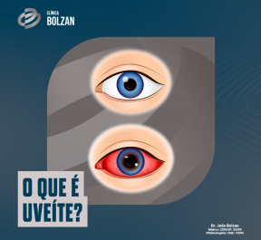 O que é uveíte?